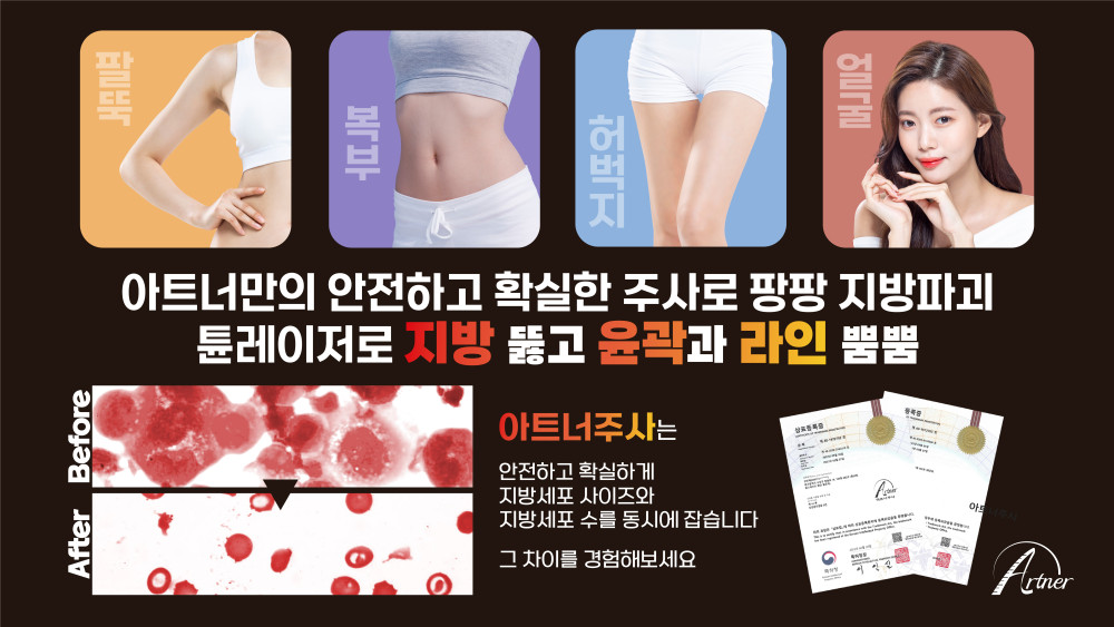 아트너주사